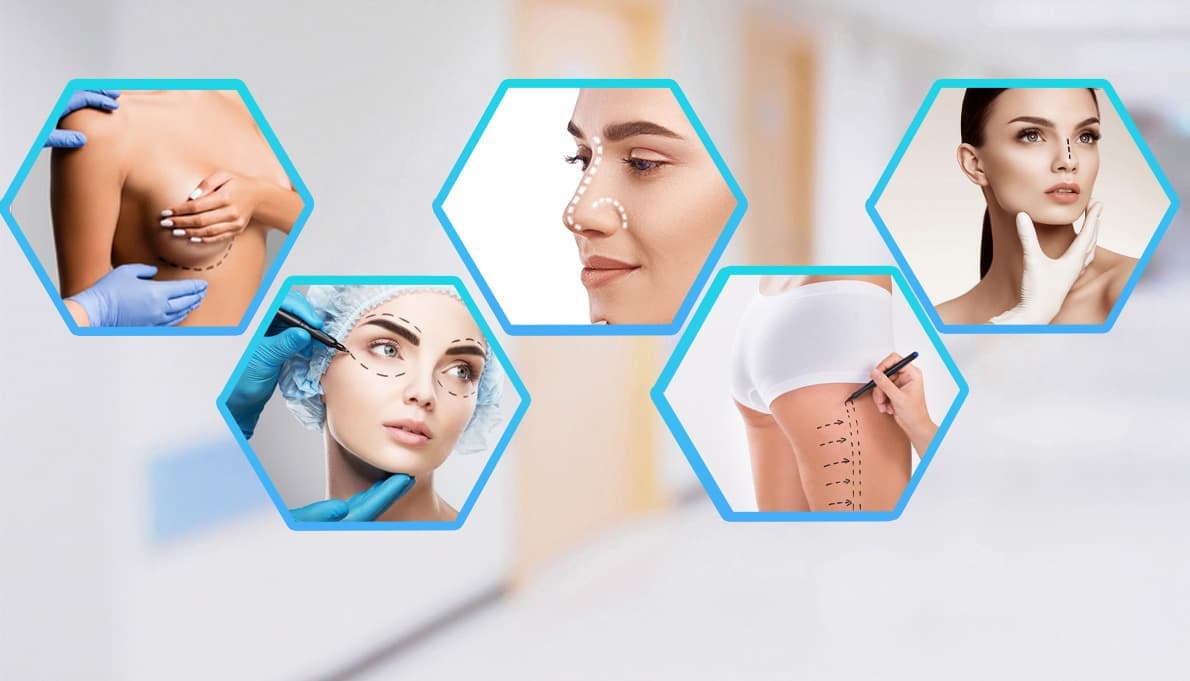 Aesthetic surgery